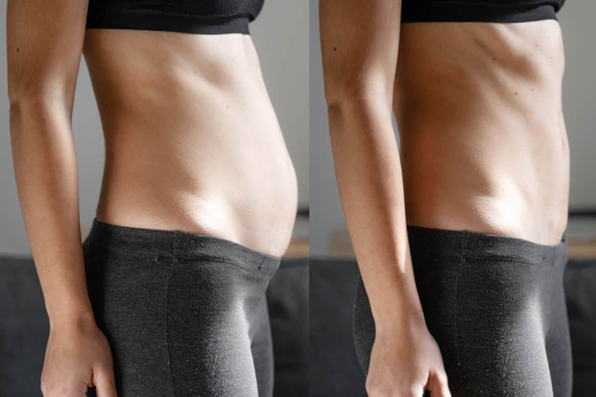 Post-Pregnancy: What Happens to Your Abdominal Muscles After Birth Horsham