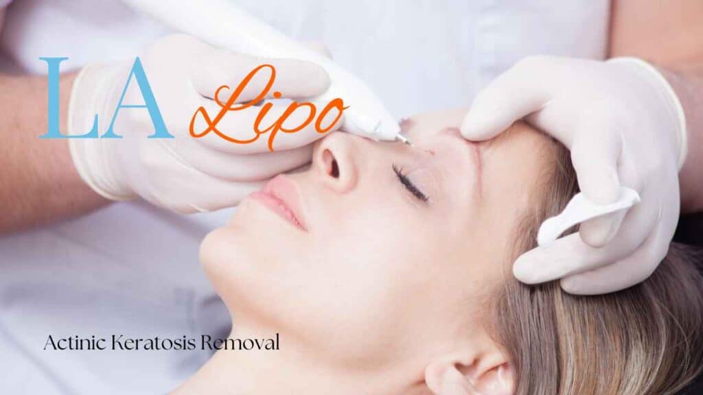 actinic keratosis removal Horsham