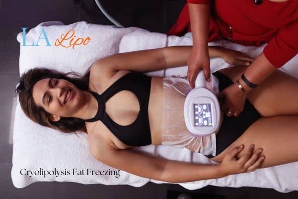 woman getting cryolipolysis Horsham