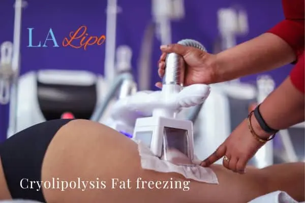 women getting fat freezing Horsham