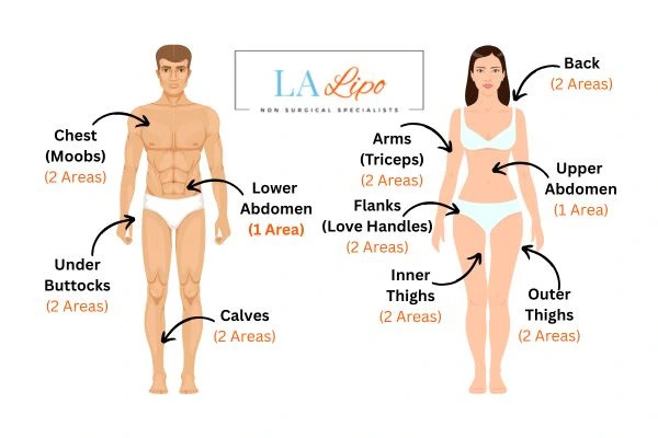 LA LIPO Cryolipolysis Areas Horsham