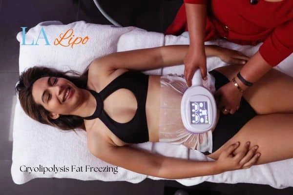 woman getting cryolipolysis Horsham