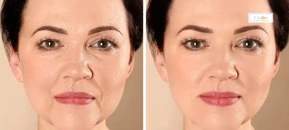 How Long Does It Take to See Results and How Long Do They Last Horsham?